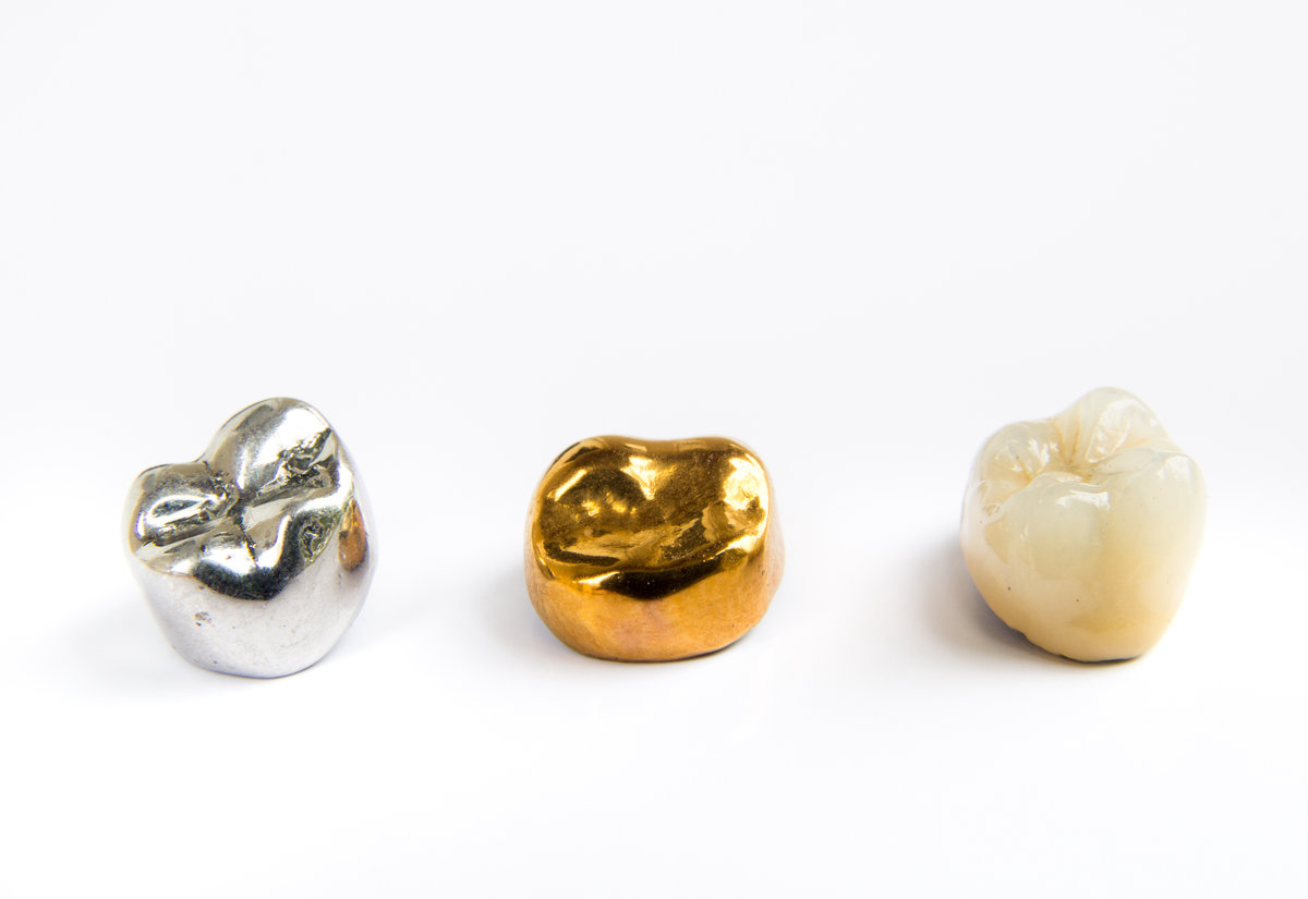 How Do Ceramic Crowns Differ from Traditional Metal Crowns?